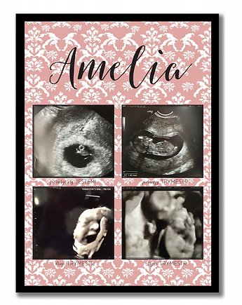 Trymestry, zdjęcie usg ciąża, plakat, baby shower, Sowia Aleja