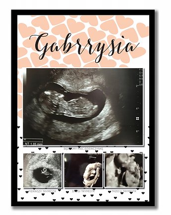 Plakat ze zdjęciami usg 3 trymestry ciąży pamiątka, Sowia Aleja