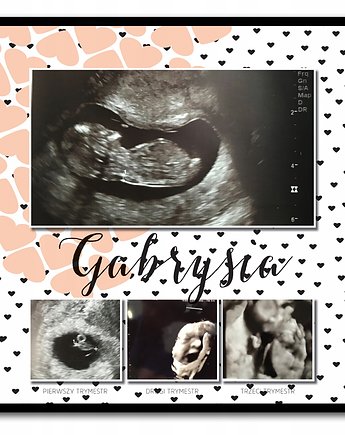 Plakat pamiątka z ciąży, zdjęcia usg, trymesty ciąży, Sowia Aleja