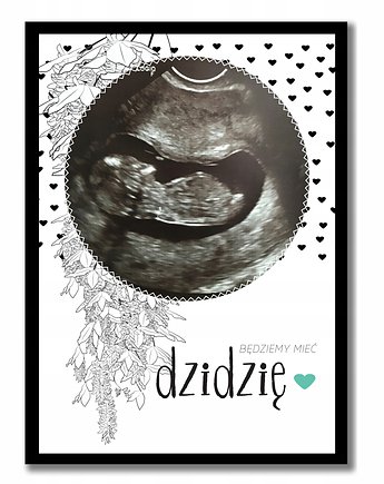 Plakat ze zdjęciem usg, w ciąży z imieniem, Sowia Aleja
