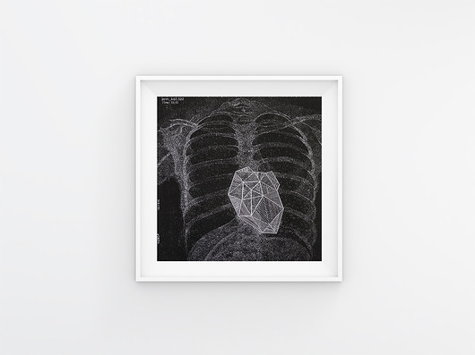 Linoryt:  Anatomy of falling for... - Heart bwitched