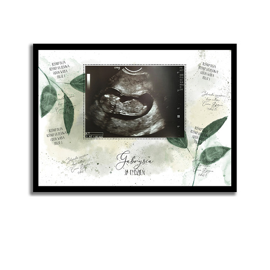 plakaty Plakat prezent na baby shower bociankowe usg ciążowe życzenia