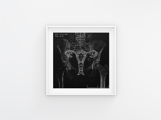 Linoryt:  Anatomy of falling for... - Intimacy bwitched