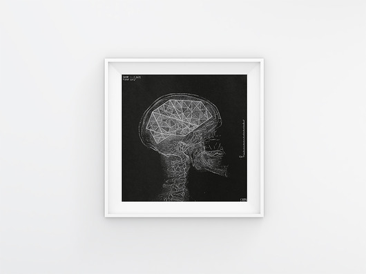 Linoryt:  Anatomy of falling for... - Brain bwitched