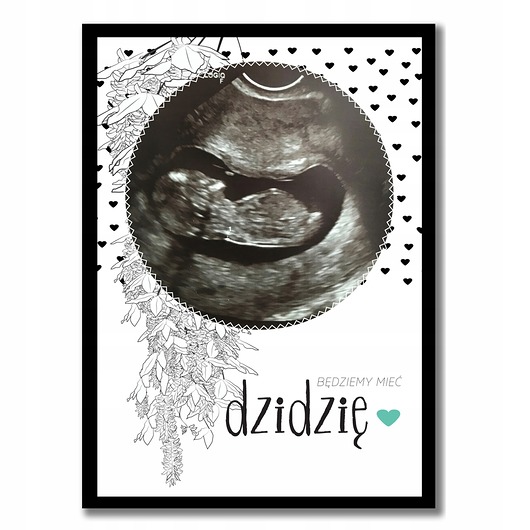 kubki Plakat ze zdjęciem usg, w ciąży z imieniem